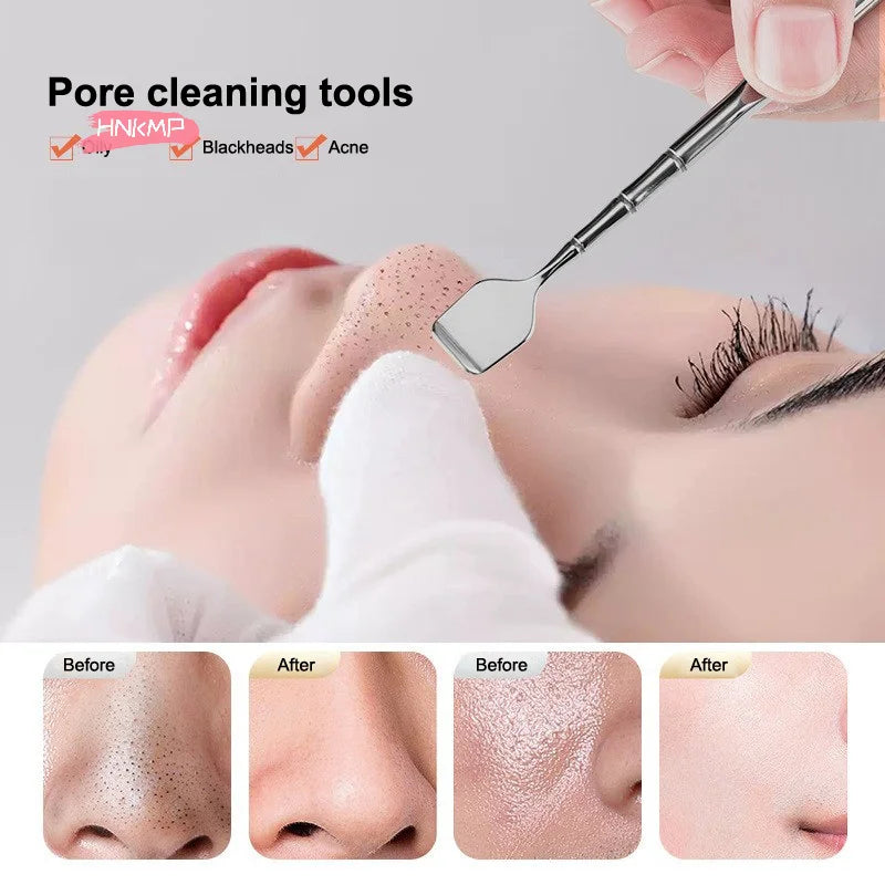 Facial Blackhead Removal Tool - Deep Cleansing Face Scraper Nose Whitehead Remover Skin Care Beauty Face Spatula